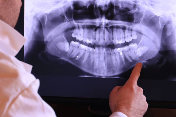 Best Pediatric Emergency Dentist in Ellettsville, IN